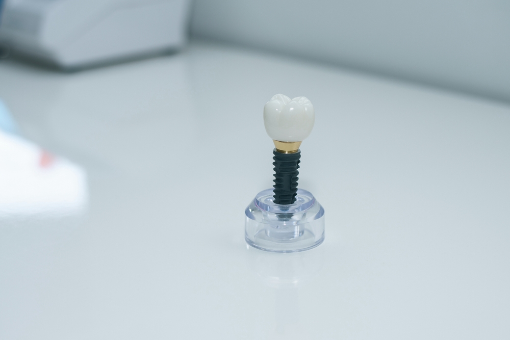 Dentist consulting a patient about dental implants and dentures.